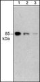 Western blot image of human A431 cells. The blots were probed with mouse monoclonal anti-PI3 Kinase, p85 (C-terminal region) at 1:1000 (lane 1), 1:2000 (lane 2), and 1:4000 (lanes 3).