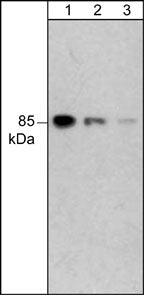 Western blot image of human A431 cells. The blots were probed with mouse monoclonal anti-PI3 Kinase, p85 (C-terminal region) at 1:1000 (lane 1), 1:2000 (lane 2), and 1:4000 (lanes 3).