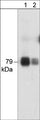 Western blot analysis of PKCθ in human Jurkat cell lysate. The blot was probed with anti-PKCθ at 1:250 (lane 1) and 1:1000 (lane 2).