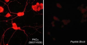 Immunocytochemical labeling of PKC phosphorylation in aldehyde-fixed and NP-40-permeabilized NGF-differentiated PC12 cells. The cells were labeled with rabbit polyclonal anti-PKCα (Ser-657/Tyr-658) (PP1091) antibody in the absence (Left) or presence (Right) of blocking peptide (PX1095). The antibody was detected using appropriate secondary antibody conjugated to DyLight® 594.