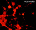 Immunocytochemical labeling of PKCδ in rat PC12 cells differentiated with NGF. The cells were labeled with mouse monoclonal PKCδ (N-terminal region) antibody, then detected using appropriate secondary antibody conjugated to Cy3.