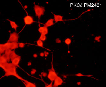 Immunocytochemical labeling of PKCδ in rat PC12 cells differentiated with NGF. The cells were labeled with mouse monoclonal PKCδ (N-terminal region) antibody, then detected using appropriate secondary antibody conjugated to Cy3.
