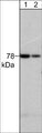 Western blot analysis of adult mouse brain tissue lysate. The blot was probed with mouse monoclonal anti-PKCδ (N-terminal region) at 1:125 (lane 1) and 1:500 (lane 2).