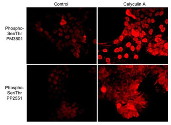 Immunocytochemical labeling of phosphoserine and phosphothreonine in control and calyculin A-treated A431 cells. The cells were labeled with mouse monoclonal anti-Phosphoserine/threonine (PM3801) and rabbit polyclonal anti-Phosphoserine/threonine (PP2551), then the antibodies were detected using appropriate secondary antibodies conjugated to Cy3.