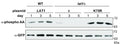 Mutant lat1Δ cells (PKY2298) expressing the indicated plasmids, as well as Mdh1-GFP, were grown in SL medium for the indicated amounts of time, and protein extracts were generated and immunoprecipitated with with α-GFP antibody. Phosphorylation of Mdh1-GFP was detected using α-phosphoamino acid antibody (Cat. PM3801), and total GFP signal in the immunoprecipitate was observed by immunoblotting with the α-GFP antibody. ϕ denotes an empty vector.