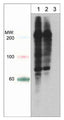 Western blot analysis of A431 cells treated with calyculin A (100 nM) for 30 min (lane 1 and 2) then treated with lambda phosphatase (lane 3). The blot was probed with anti-Phosphoserine/threonine mouse monoclonal at 1:250 (lane 1) or 1:1000 (lanes 2 & 3).