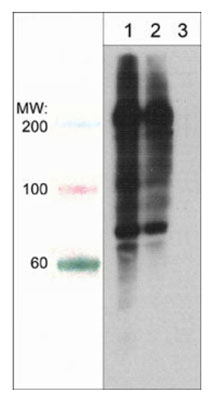 Western blot analysis of A431 cells treated with calyculin A (100 nM) for 30 min (lane 1 and 2) then treated with lambda phosphatase (lane 3). The blot was probed with anti-Phosphoserine/threonine mouse monoclonal at 1:250 (lane 1) or 1:1000 (lanes 2 & 3).
