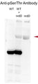 In vitro kinase assay of nrdD stained with a serine/threonine site-specific antibody (Cat. PM3801). Image from publication CC-BY-4.0. PMID: 38683735