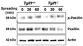 Wesern blot image of cultured mouse osteoblasts +/-TG-interacting factor 1 (Tgif1). Tgif1 deficiency does not alter the abundance or activation of the FA components and Tgif1 does not co-localize with FA complexes. The representive western blot demonstrates the abundance of p-Paxillin (ser83,  Cat no PP 1341, 1:1000) and Paxilllin. Actin was used as a loading control. Image from publication, CC-BY-4.0. PMID: 38661167.