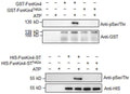 Western blot image of plant extracts with intact FonKin4 and truncated S_TKc domain-containing fragment FonKin4-ST show Ser/Thr protein kinase activity detected by anti-phospho Ser/Thr antibody (Cat. PP2551). FonKin4 is a Ser/Thr protein kinase and its S_TKc domain is sufficient for its pathogenicity function in Fon. Image from