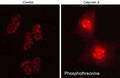 Immunocytochemical labeling of phosphothreonine upregulation in control (left) or calyculin A-treated HeLa cells (right). The cells were labeled with rabbit polyclonal anti-Phosphothreonine (PP4641). The antibody was detected using goat anti-rabbit DyLight® 594.
