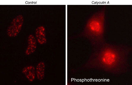 Immunocytochemical labeling of phosphothreonine upregulation in control (left) or calyculin A-treated HeLa cells (right). The cells were labeled with rabbit polyclonal anti-Phosphothreonine (PP4641). The antibody was detected using goat anti-rabbit DyLight® 594.
