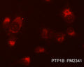Immunocytochemical labeling of PTP1B in methanol and acetone fixed human NCI-H1915 lung carcinoma cells. The cells were labeled with mouse monclonal anti-PTP1B (PM2341) antibody. The antibody was detected using appropriate secondary antibody conjugated to DyLight® 594.