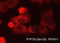 Immunocytochemical labeling of PTP1B in aldehyde-fixed and NP-40 permeabilized human NCI-H1915 lung carcinoma cells. The cells were labeled with rabbit polyclonal anti-PTP1B (Ser-50) (PP2411) phosphospecific antibody. The antibody was detected using appropriate secondary antibody conjugated to DyLight® 594.
