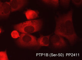 Immunocytochemical labeling of PTP1B in aldehyde-fixed and NP-40 permeabilized human NCI-H1915 lung carcinoma cells. The cells were labeled with rabbit polyclonal anti-PTP1B (Ser-50) (PP2411) phosphospecific antibody. The antibody was detected using appropriate secondary antibody conjugated to DyLight® 594.