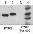 Western blot analysis of human Jurkat cells untreated (lanes 1 & 3) or treated with pervanadate (1 mM) for 30 min. (lanes 2 & 4). The blot was probed with anti-PYK2 (C-terminal region) antibody (lanes 1 & 2) or anti-PYK2 (Tyr-402) (lanes 3 & 4).