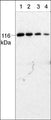 Western blot analysis of mouse brain. The blot was probed with anti-PYK2 (C-terminal region) antibody at 1:250 (lane 1), 1:500 (lane 2), 1:1000 (lane 3), and 1:2000 (lane 4).