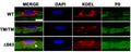 Representative immunofluorescence images of mouse sciatic nerve teased fibers at postnatal day 30. Fibers were stained for P0 (Cat. PZO; green), endoplasmic reticulum (ER) (KDEL, red), and DAPI (blue). Image from publication CC-BY-4.0. PMID: 36350884