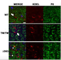 Representative immunofluorescence images of mouse sciatic nerve cross sections at 2 months of age. Cross sections were stained for P0 (Cat. PZO; green), endoplasmic reticulum (ER) (KDEL, red), and DAPI (blue). Image from publication CC-BY-4.0. PMID: 36350884