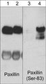 Western blot analysis of PC12 cells untreated (lanes 1 & 3) or treated with NGF (200 ng/ml) for 60 min (lanes 2 & 4). The blots were probed with mouse monoclonal anti-Paxillin (PM1071; lane 1 & 2) or rabbit polyclonal anti-Paxillin (Ser-83) phospho-specific antibody (lane 3 & 4).