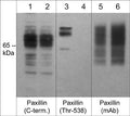 Western blot analysis of human A431 cells treated with Calyculin A (100 nm) for 30 min (lanes 1-6). The blot was treated with lambda phosphatase (lanes 2, 4, & 6), then probed with rabbit polyclonal anti-Paxillin (C-terminal; PP1161) (lanes 1 & 2), anti-phospho-Paxillin (Thr-538; PP4491) (lanes 3 & 4), and mouse monoclonal anti-Paxillin (PM1071) (lanes 5 & 6).