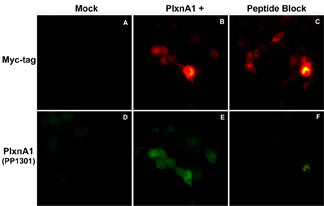 Immunocytochemical double labeling using anti-Myc mouse monoclonal and anti-Plexin-A1 rabbit polyclonal (PP1301) antibodies in Cos-7 cells mock transfected (A,D) or transfected with Myc-tagged mouse Plexin-A1 construct (B,E). The specificity of the binding in E was demonstrated by using Plexin-A1 peptide (PX1305) in the presence of this anti-Plexin-A1 antibody (C,F).