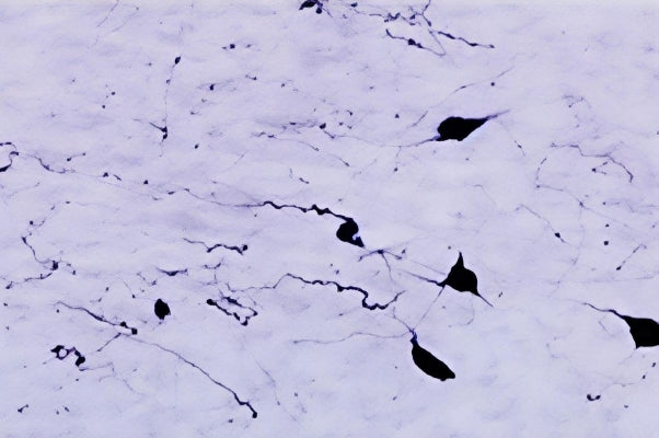 Biosensis R-104-100 cleanly labels individual orexin A-positive neuronal somata and processes in the rat hypothalamic/zona incerta region, providing crisp cellular detail with minimal background. The antibody resolves the morphology of individual orexinergic neurons, including cell bodies and projecting processes, with little distracting background. The antibody is valuable for researchers studying orexin-system anatomy, arousal and sleep-wake circuitry, feeding, and hypothalamic network organization.