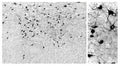 Orexin A-immunoreactive cell bodies and fibers were visualized in floated cryostat sections of the rat lateral hypothalamus. Left: lower-power image; right: higher-magnification image demonstrating excellent neuronal definition by the antibody. Numerous intensely labeled orexin A-immunoreactive somata are observed, accompanied by clearly resolved processes and a rich surrounding fiber network, with low background and excellent contrast. The staining highlights the characteristic distribution and morphology of orexinergic neurons in the lateral hypothalamic region. The R-104-100 antibody (1:50 000) was detected with the biotinylated secondary antibody ABC method and nickel diaminobenzidine chromogen. Photo courtesy of Dr. Erik Hrabovszky, Hungarian Academy of Sciences, Budapest, Hungary.