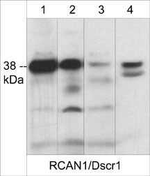 Western blot analysis of RCAN1 expression in human Jurkat (lane 1), rat PC12 (lane 2), human A431 (lane 3), and adult mouse muscle (lane 4). The blot was probed with rabbit polyclonal anti-RCAN1 (C-terminus) at 1:1000.