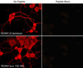 Immunocytochemical labeling of RCAN1 in aldehyde-fixed NGF-differentiated PC12 cells. The cells were labeled with rabbit polyclonal anti-RCAN1 (C-terminus) (RP3941) and anti-RCAN1 (a.a. 132-140) (RP3961) antibodies (Left side). These antibodies were also used in the presence (Right side) of blocking peptide RX3945 and RX3965, respectively. The antibodies were detected using appropriate secondary antibody conjugated to DyLight® 594.
