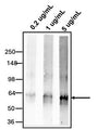 Western blotting of HeLa Cell lysate using 0.2 ug/mL, 1 ug/mL, or 5 ug/mL rabbit polyclonal anti-MUC2 antibody (RP-4013). RP-4013 rabbit anti-MUC2 antibody recognizes endogenous Mucin 2 at ~ 64 kDa (Tris- Glycine).