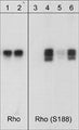 Western blot analysis of human RhoA GST fusion recombinant unphosphorylated (lanes 1 & 3) or phosphorylated with PKA (lanes 2, 4, 5 & 6). The blots were probed with anti-Rho (RP1501; lanes 1 & 2) or with anti-RhoA (Ser-188) (RP1361; lanes 3-6). The latter antibody was used in the presence of no peptide (lanes 3 & 4), phospho-Rho (Ser-188) peptide (lane 5), or a non-specific phosphoserine peptide (lane 6).