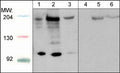 Western blot analysis of HepG2 (lanes 1 & 4), C2C12 (lanes 2 & 5), and HUVEC (lanes 3 & 6). The blot was probed with anti-Robo1 (C-terminal region) in absence (lanes 1-3) or presence of Robo1 (C-terminal region) blocking peptide (RX2795; lanes 4-6).