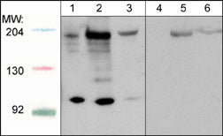 Western blot analysis of HepG2 (lanes 1 & 4), C2C12 (lanes 2 & 5), and HUVEC (lanes 3 & 6). The blot was probed with anti-Robo1 (C-terminal region) in absence (lanes 1-3) or presence of Robo1 (C-terminal region) blocking peptide (RX2795; lanes 4-6).