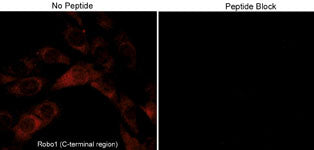 Immunocytochemical labeling of Robo1 in mouse C2C12. The cells were labeled with rabbit polyclonal Robo1 (C-terminal region) in the absence or presence of blocking peptide (RX2795). The antibody was then detected using appropriate secondary antibodies conjugated to Cy3.