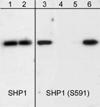 Western blot analysis of human Jurkat cells treated with pervanadate (1 mM) for 30 min. The blot was exposed to lambda phosphatase (lanes 2 & 4) then probed with anti-SHP1 (C-terminal) antibody (lanes 1 & 2) or anti-SHP1 (Ser-591) antibody (lanes 3-6). The SHP1 (Ser-591) antibody was used in the presence of phospho-SHP1 (Ser-591) peptide (lane 5) or a non-specific phospho-serine peptide (lane 6).