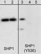 Western blot analysis of human Jurkat cells treated with pervanadate (1 mM) for 30 min. The blot was exposed to alkaline phosphatase (lanes 2 & 4) then probed with anti-SHP1 (C-terminal) antibody (lanes 1 & 2) or anti-SHP1 (Tyr-536) antibody (lanes 3-5). The SHP1 (Tyr-536) antibody was used in the presence of phospho-SHP1 (Tyr-536) peptide (lane 5).
