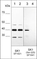 Western blot of HeLa stimulated with calyculin A (lanes 1-4). The blots were untreated (lane 1 & 3) or treated with lambda phosphatase (lane 2 & 4), then probed with anti-SK1 (Central region) SP1621 (lanes 1 & 2) or anti-SK1 (Ser-225) SP1641 (lanes 3 & 4).