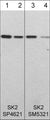 Western blot of human recombinant SK2 (lanes 1-4). The blots were probed with rabbit polyclonal anti-SK2 (N-terminal region) at 1:250 (lane 1) and 1:1000 (lane 2) or with mouse monoclonal anti-SK2 (N-terminal region) at 1:250 (lane 3) or 1:1000 (lane 4).