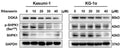 The protein expression levels of DGKα, SphK1 (Cat. SP5421, 1:1000) and p-SphK1(Ser225) (Cat. SP1641) in AML cells after ritanserin treatment for 48 h. Image from publication CC-BY-4.0. PMID: 37392305