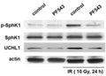In separate experiments, human pulmonary artery ECs were treated with a pharmacologic SphK1 inhibitor, PF-543 (10 µM), 1 h prior to irradiation, followed by Western blotting for p-SphK1 (Cat. SP1641), SphK1, and UCHL1. Representative blots are shown. Image from publication CC-BY-4.0. PMID: 37830619