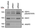 DU-145 cells were transfected with control (Ctrl siRNAs) or AKAP2 specific siRNAs (siRNA1 and siRNA2). 72 h after transfection, cell lysates were loaded on SDS-PAGE gels and analyzed by Western blot. Phospho-SSH1 was detected using antibodies recognizing phospho-serines 937 and 978 (Cat. SP3901). The amounts of SSH1 (Cat. SP1711) and AKAP2 were detected using specific antibodies, as indicated. Image from publication CC-BY-4.0. PMID: 37827203