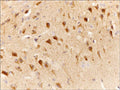 Formalin fixed, citric acid treated parafin sections of mouse cerebral cortex. Sections were probed with anti-Slingshot-1L (SP1711) then anti-Rabbit:HRP before detection using DAB. (Image provided by Carl Hobbs and Dr. Pat Doherty at Wolfson Centre for Age-Related Diseases, King's College London).