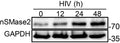 Representative immunoblots showing expression of nSMase2 (Cat. SP4061, 1:1000) at the indicated timepoints (0 to 48 h) following HIVRF infection of H9 cells. Image from publication CC-BY-4.0. <a