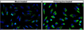Immunofluorescent staining of mock- or 50 µM chloroquine-treated HeLa cells using 2 µg/mL chicken anti-SQSTM1 (p62) antibody (green). DAPI nuclear stain (blue) shows cell nuclei. The cells were mounted with Antibodies Incorporated Fluoroshield with DAPI mounting medium (Cat. AR-6501). Anti-SQSTM1 (p62) specifically stains the autophagosomes in HeLa cells. ​Chloroquine treatment increases the levels of SQSTM1 (p62) protein by inhibiting autophagy.