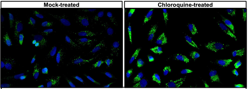 Immunofluorescent staining of mock- or 50 µM chloroquine-treated HeLa cells using 2 µg/mL chicken anti-SQSTM1 (p62) antibody (green). DAPI nuclear stain (blue) shows cell nuclei. The cells were mounted with Antibodies Incorporated Fluoroshield with DAPI mounting medium (Cat No. AR-6501). Anti-SQSTM1 (p62) specifically stains the autophagosomes in HeLa cells. ​Chloroquine treatment increases the levels of SQSTM1 (p62) protein by inhibiting autophagy.