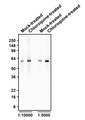 Western blotting of mock- or 50 µM chloroquine-treated HeLa cell lysates with Aves Labs chicken anti-SQSTM1 (p62) antibody at 1:5000 (0.04 µg/ml) and 1:10000 (0.02µg/ml) dilutions and detected with goat anti-chicken HRP. Aves Labs Chicken anti-SQSTM1 (p62) recognizes endogenous SQSTM1 (p62) in HeLa cells at ~62 kDa. Chloroquine treatment increases the levels of SQSTM1 (p62) protein by inhibiting autophagy.