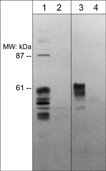 Anti-Semaphorin-3E (N-terminal region) Antibody | SP4461