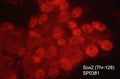 Immunocytochemical labeling of phosphorylated Sox2 in aldehyde fixed and NP-40 permeabilized human NCI-H446 lung carcinoma cells. The cells were labeled with rabbit polyclonal anti-Sox2 (Thr-128) phospho-specific (SP0381). The antibody was detected using goat anti-rabbit Ig:DyLight® 594.