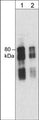 Western blot of mouse brain lysate. The blot was probed with mouse monoclonal anti-Synapsin I (C-terminal region) antibody at 1:250 (lane 1) or 1:1000 (lane 2).